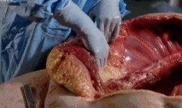 解剖吃瓜事件图片,揭秘人体器官的奇妙之旅