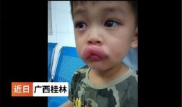 吃瓜过敏继续吃外国人,一场跨文化的美食冒险